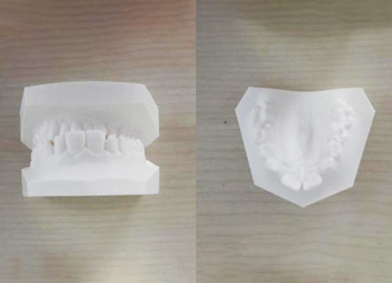 Medical - Case 14 Laboratoire Ortho 34