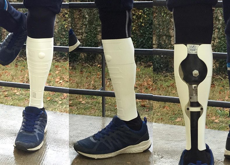 Medical - Case 15 Prosthetics